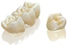 Dental Crowns