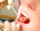 Dental Cleanings