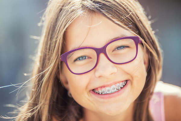 Traditional Dental Braces