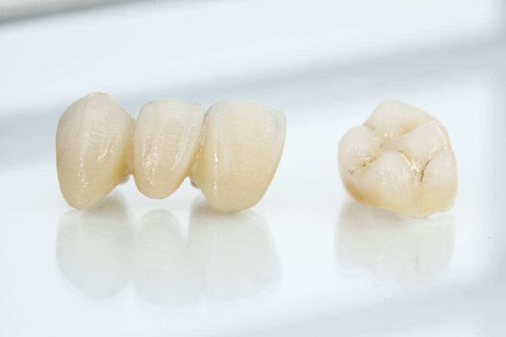 Are Dental Crowns Painful Procedures?