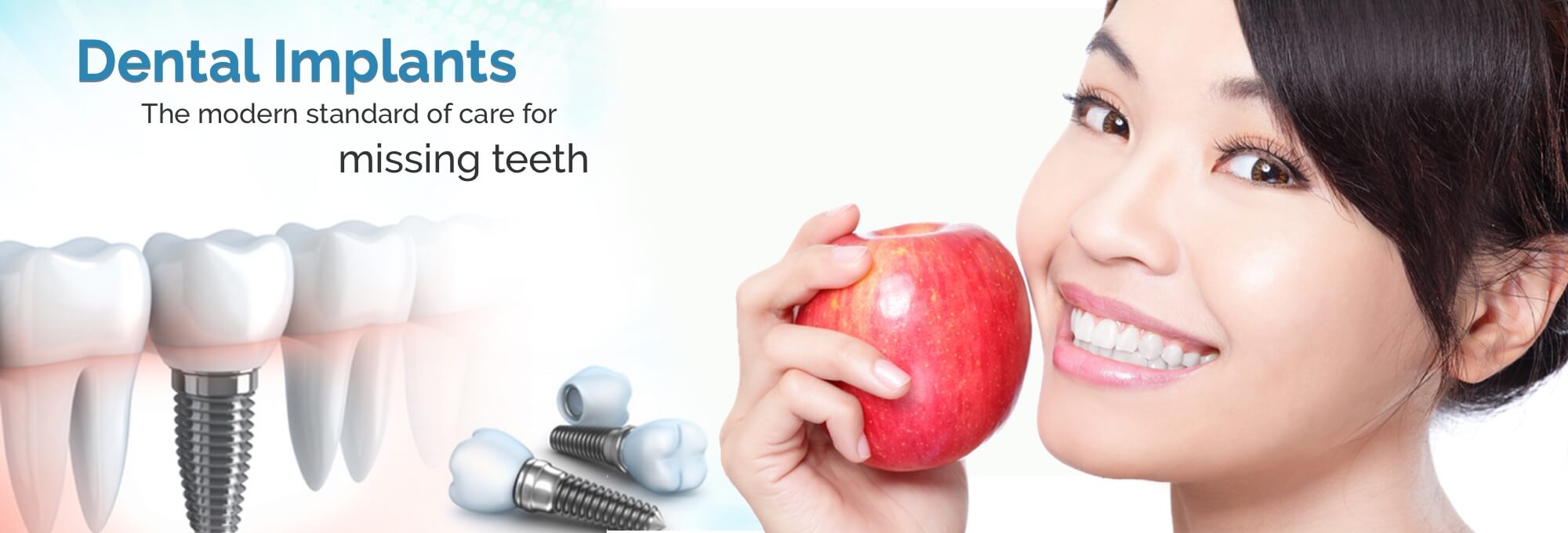 Dental Implants in Chino CA