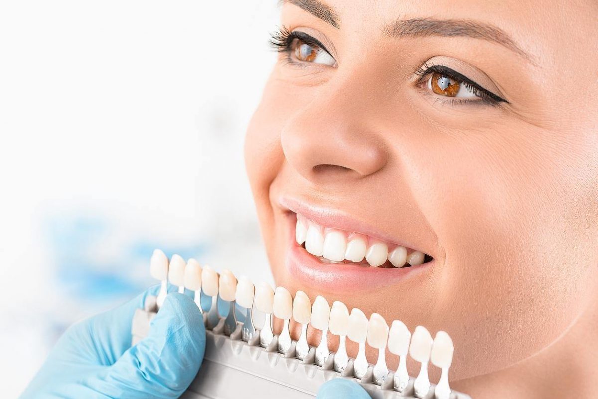 Dental Veneers: What to Expect During Your Veneers Procedure