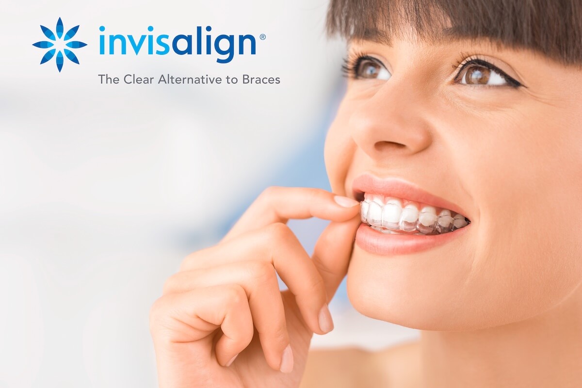 orthodontiste tours invisalign